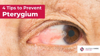 Prevent pterygium article header – First Aid Article in Kiama